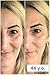 Vitayes Instant Ageback, Ageless Facelift Cream for Instant Eye Bag Removal, Under Eye Bags, Eye Dark Circle, Fine Lines on Eye Bags (x26 Sachets)