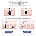 Blackhead Remover, Eitpoton Electric Blackhead Vacuum Suction Removal, Acne Comedone Extractor Tool Set, Skin Facial Pore Cleaner, Comedo Microdermabrasion Exfoliating Machine for Women and Men