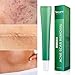 Scar Removal Cream Advanced Treatment for Face & Body Old & New Scars from Cuts Stretch Marks, C-Sections & Surgeries With Natural Herbal Extracts Formula