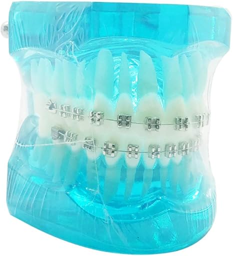 Amazon Co Jp 患者のための歯の矯正モデルは 歯科ブレース歯科医が歯科ツールを教える歯磨き指導モデルを学びます ホーム キッチン