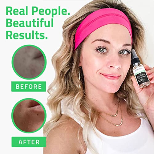 Glycolic Acid Peel for Face Professional 30 Gel with Retinol & Green