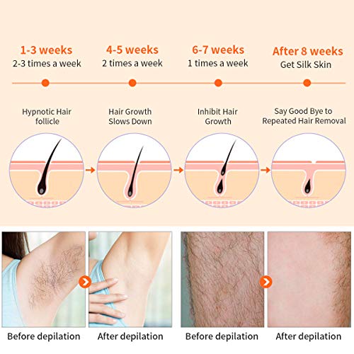 IPL Laser Facial Hair Removal for Women -500,000 Flashes Painless Permanent Hair Remover