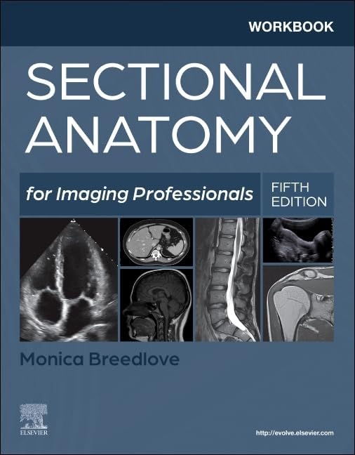 Abdominal Imaging: Expert Radiology Series: 9780323377980