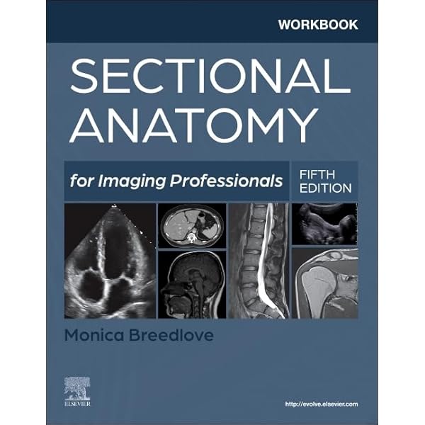 Cross Sectional Anatomy CT & MRI: 8601415720037: Medicine & Health