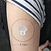 No-Hole 25-Pack Freestyle Libre, Enlite, Medtronic Guardian Adhesive Patches, Pre Cut Waterproof CGM Patches, Hypoallergenic Medical Tape, Continuous Glucose Monitor Protection Stickers for Diabetics