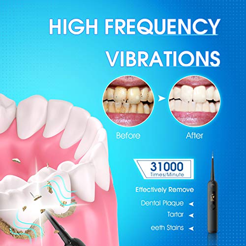 Plaque Remover for Teeth, iFanze Teeth CleanerElectric Dental Calculus