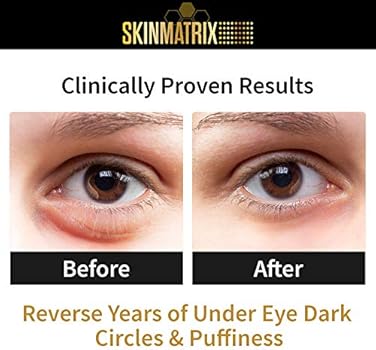 vitamin k for dark circles
