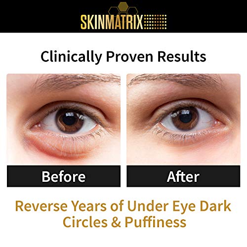 Vitamin K Cream Reduces the Appearance of Bruising, Dark Under Eye