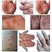 2 PCS Psoriasis Cream, Psoriasis Treatment Cream, Foot Cream, Natural Chinese Herbal Eczema Ointment