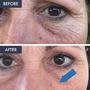 biobare vitamin c serum amazon