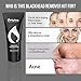 Blackhead Remover Mask [Removes Blackheads] - Purifying Quality Black Peel off Charcoal Mask - Best Mud Facial Mask 60 gram (2.11 ounce) (Pack of 3)