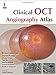 Clinical OCT Angiography Atlas