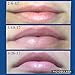 SeneDerm Solutions Lip Volumizer
