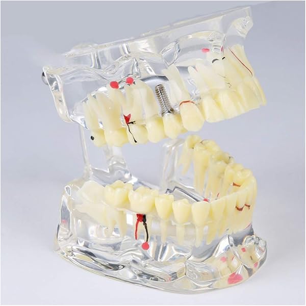 Easyinsmile 1Pc Dental Typodont Removable Tooth Teach Practice Model Universal 200H - View #5