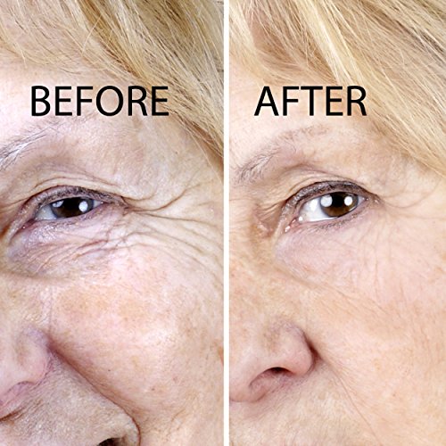 Advanced Clinicals Rosehip Oil Antiwrinkle Face Oil with Vitamin C and