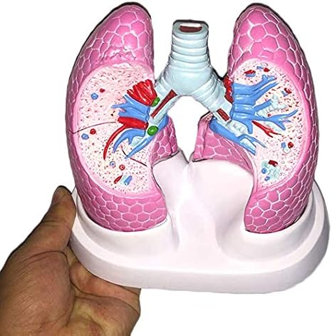 Amazon Com Lbylyh Anatomical Model Human Lung Pathology Bronchopulmonary Visceral Organ Demonstration Healthy And Pulmonary Sick Home Kitchen
