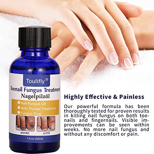 3 Natural+Treatment+Maximum+Strength+Solution