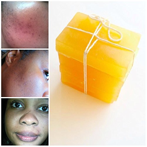 Skin Lightening Brightening Tone Soap-Kojic Acid-Honey with Cerasee (Vitamin A)-Arbutin-Papaya-Glutathione-Niacin B3-Cerasee-Carrot Oil-Skin Lightening-HANDMADE SOAP Anti Aging Acne-Darkpots (2 Bars) Skin Lightening Brightening Tone Soap-Kojic Acid-Honey with Cerasee (Vitamin A)-Arbutin-Papaya-Glutathione-Niacin B3-Cerasee-Carrot Oil-Skin Lightening-HANDMADE SOAP Anti Aging Acne-Darkpots (2 Bars)