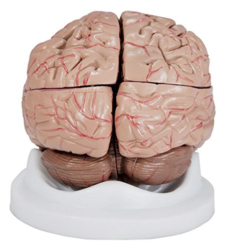 Budget Brain with Arteries Model