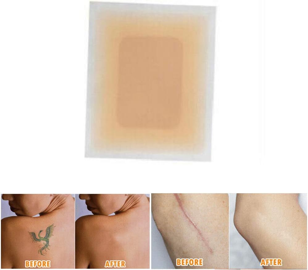 CHUANGE Tattoo & Flaw Covers Skin Shields Concealing Tapes Hiding Tattoo Flaw