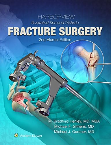 Amazon.com: Rockwood and Wilkins' Fractures in Children: eBook