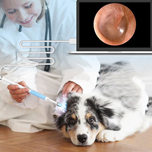 Ear Otoscope,TryAce 1.3MP 720P HD Ear Scope Inspection Camera 3 In 1 USB Ear Digital Endoscope Earwax Cleansing Tool with 6 Leds for Micro USB,USB-C Android Phone,Windows MAC PC - Thumbnail 6