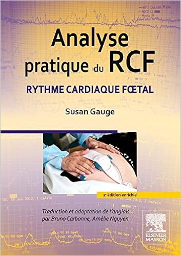 Analyse Pratique Du Rcf Rythme Cardiaque Foetal Hors Collection French Edition Gauge Susan Carbonne Bruno Nguyen Amelie 9782294733819 Amazon Com Books