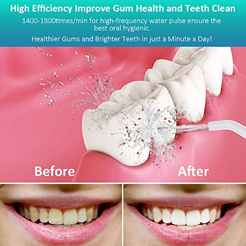 Upgrade Cordless Water Flosser,Homgeek 320ML Oral Irrigator,Water Pick,Dental Water Flosser,Portable High-frequency Pulsation Anti Leakage Water Pick Teeth Cleaner for Home,Travel,IPX7 Waterproof