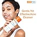 Acnefree Oil Free Acne Cleanser, 8 Ounce (Pack of 2)