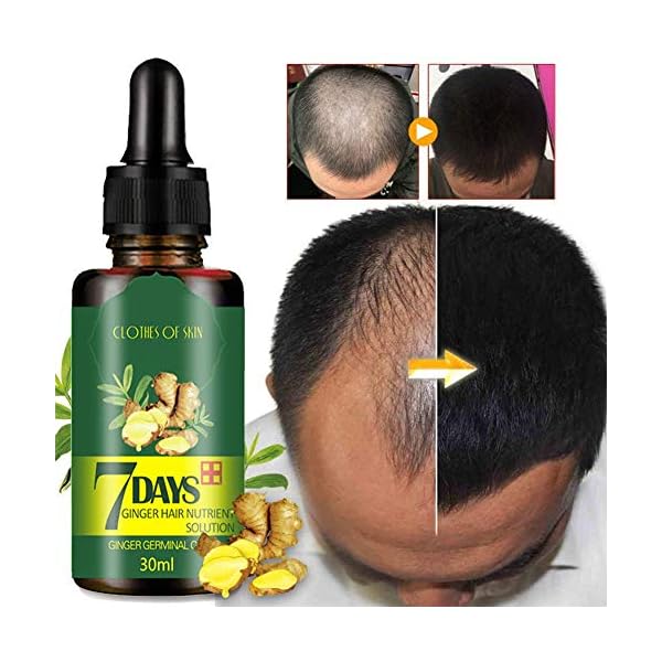 Ginger-Germinal-Oil-3-PACK2020-Hair-Growth-TreatmentHair-SerumAnti-Hair-Loss-Thinning-Balding-Repairs-Hair-Follicles-Promotes-Thicker-Stronger-Hair-And-Promotes-Hair-Regrowth Ginger Germinal Oil 3 PACK,2020 Hair Growth Treatment,Hair Serum,Anti Hair Loss, Thinning, Balding, Repairs Hair…