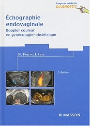 Échographie endovaginale