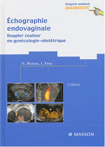 Échographie endovaginale