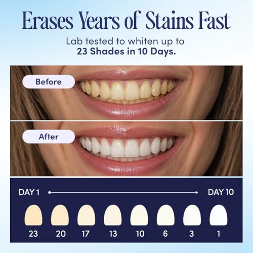 BocaBella Teeth Whitening Trays U-Wraps - 15% Hydrogen Peroxide Whitening Strips & Tray Alternative - Nano-Hydroxyapatite Enamel Safe - 10 Treatments - Up to 23 Shades Whiter - No Harsh Sensitivity
