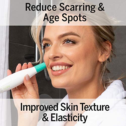 Silk'n Revit - Blackhead Remover Vacuum -Microdermabrasion Machine - Age Spot Reducer and Improves Skin Texture - Cleansing Exfoliating Face Scrub Pore Vacuum