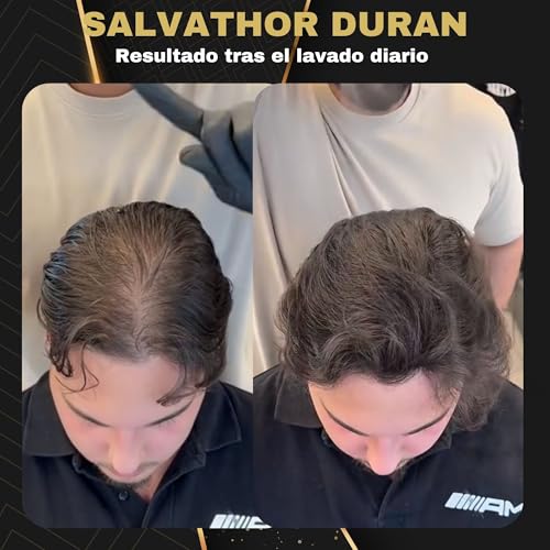 Salvathor Durán Simil Hair Fibers – Hair Concealer for Scalp – Alternative to Men's Hair Dye, Hair Fibers and Powder for Men – Conceals Baldness and Volumizes (Black, 50 ml)