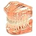 AZDENT Dental Study Teaching Teeth Model Adult Typodont Model Removable Tooth(Color Orange)