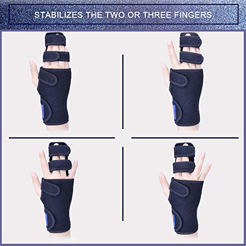 Trigger Finger Splint for Two or Three Finger Immobilizer - Post Operative Care Support for Broken Joints, Sprains, Contractures, Arthritis, Tendonitis and Pain Relief (Left, L/XL)