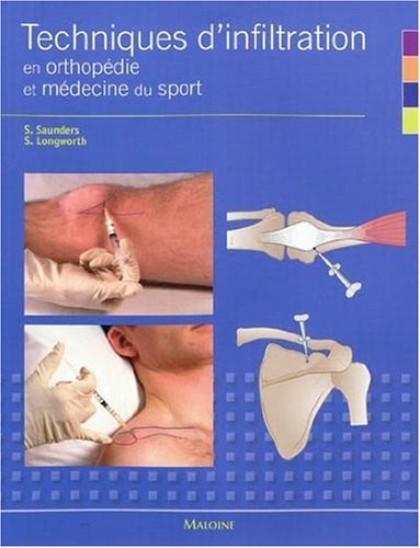 Techniques d'infiltration en orthopédie en médecine du sport