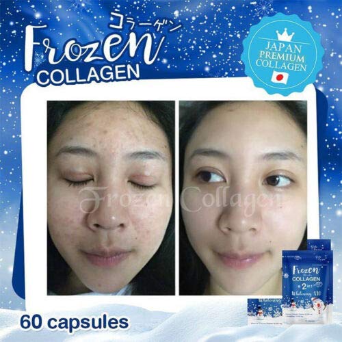 frozen glutathione review x10 Collagen Whitening Peptides Bright Skin Anti-Aging Acne 12X Frozen Collagen 2 in