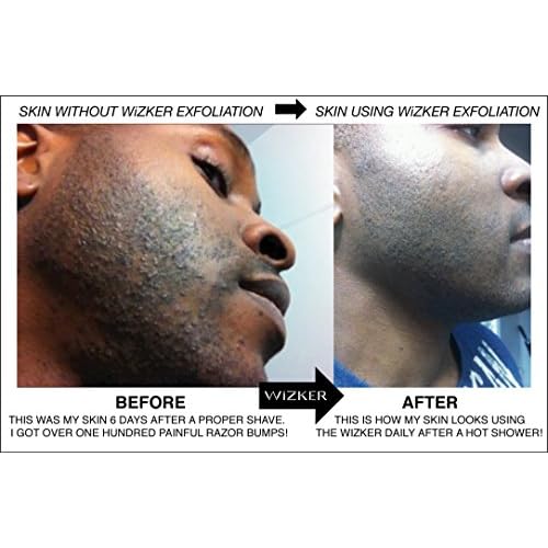 Durable Service Wizker Brush Eliminates Razor Bumps And Ingrown