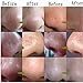 Blackhead Remover Mask, LuckyFine Deep Cleansing the Black Head,Acne Treatments Masks,Blackhead Mask