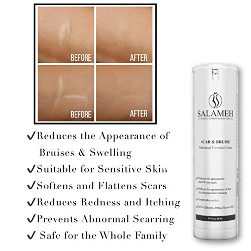 Doctor Salameh Scar and Bruise Cream Reduces The Appearance of Scars