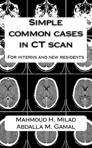 Simple common cases in CT scan: For interns and new residents
