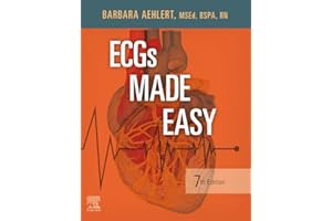 ECGs Made Easy - E-Book