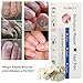 Toenail Fungus Treatment, Fungus Stop, Toenail Antifungal Care, Nail Fungus Treatment pen, Fungal Nail Gel, Anti Fungus Nail Treatment, Nail Fungus Solution Effective against nail fungus (3ml4)