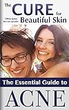 ACNE: The Essential Guide to Acne (Makeup, Clear Skin, Acne, Acne Cure, Acne Remedy) (Cure Acne, Clear Skin, Acne Remedy, Medicine for Acne)