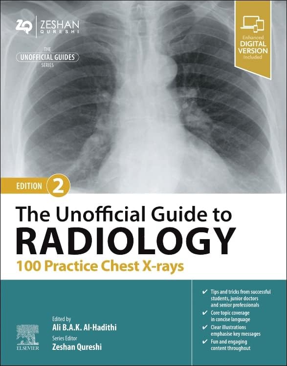 Chest X-Rays for Medical Students: CXRs Made Easy: 9781119504153