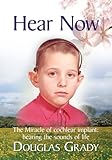 Hear Now: The Miracle of cochlear implant: hearing the sounds of life
