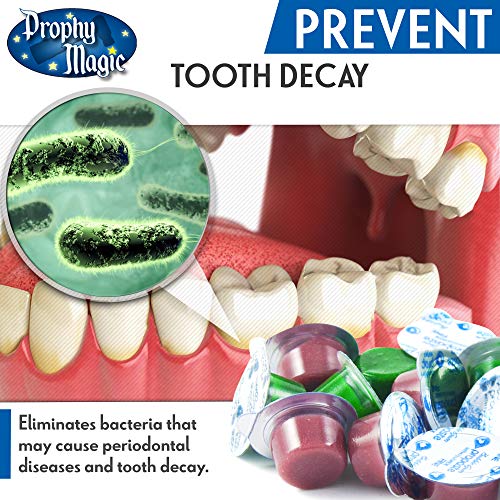 Flavored GlutenFree Prophy Paste by Prophy Magic, NonSplatter Formula