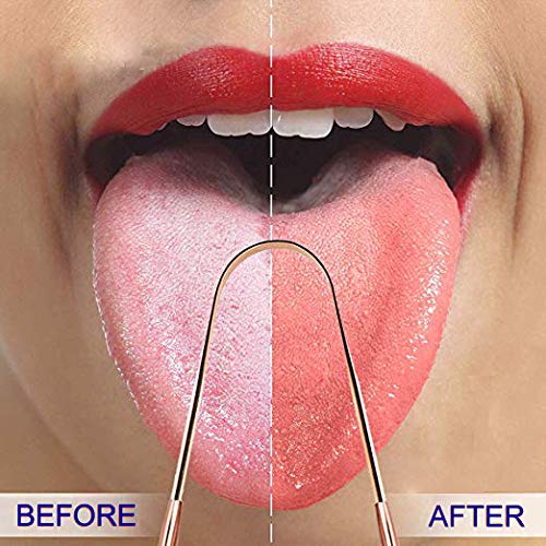 Tounge Scraper Cleaner, 2-Pack Stainless Steel Tongue Cleaner Rose Gold Tongue Scarper